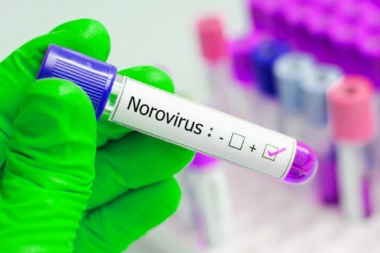Norovirus: expertos estiman que en 4 meses podrían producirse 65 millones de contagios