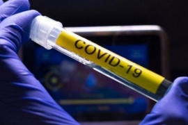 Coronavirus en Santa Cruz: 297 nuevos positivos y 2 fallecimientos