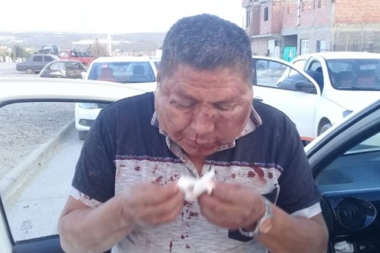 El taxista agredido en Puerto Madryn. 