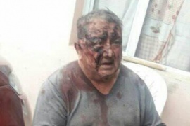 Le robaron y golpearon brutalmente a un abuelo en el barrio Los Lolos