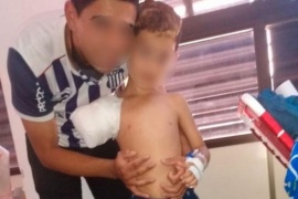 Un nene de 6 años perdió el brazo tras meterlo en el secarropas