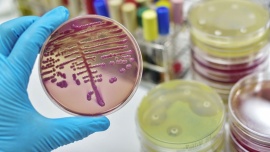 Los antibióticos nuevos no combaten la farmacorresistencia de bacterias peligrosas