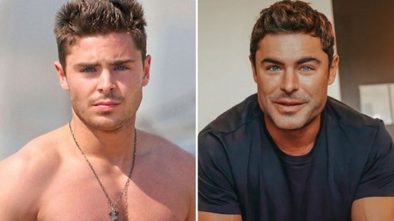 La nueva cara de Zac Efron generó una ola de burlas en las redes sociales