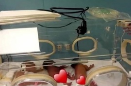 Mujer que esperaba septillizos causó sorpresa al dar a luz finalmente a nueve bebés