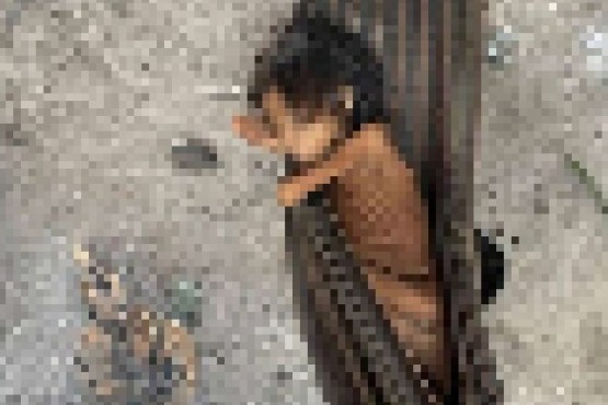 La desgarradora foto de una nena de 8 años que pesa 12 kilos que conmovió a Brasil