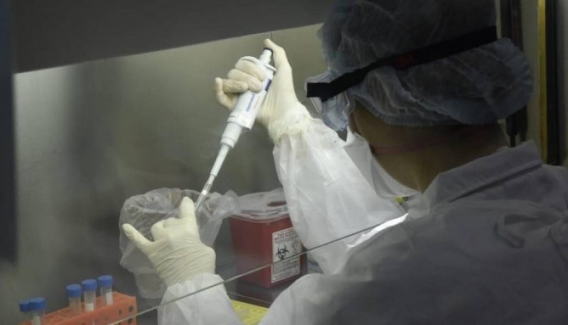 El Gobierno confirmó un caso de “hongo negro” en una paciente recuperada de coronavirus