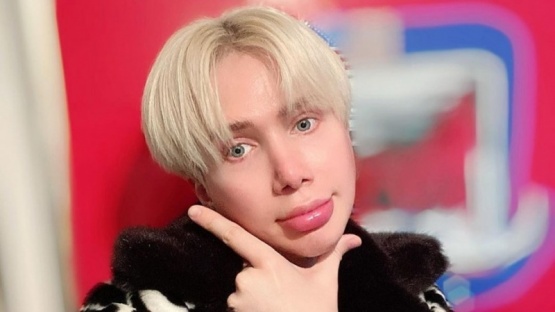 El influencer que se operó 18 veces para lucir como cantante de BTS