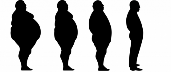 Obesidad: De los mitos a las soluciones