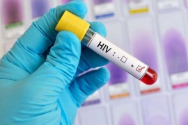 Una argentina es la segunda paciente con VIH en curarse sin tratamiento