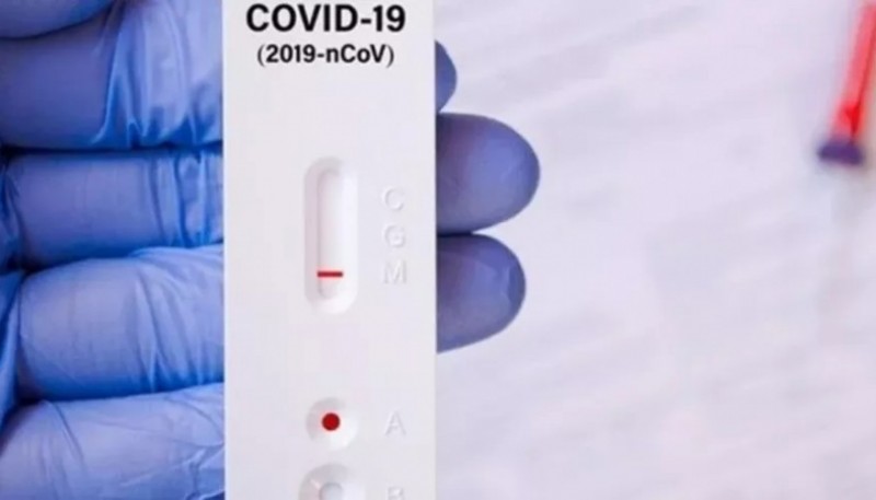 Los test de autoevaluación de COVID-19 fueron aprobados por ANMAT.