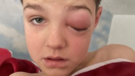 "Ojo covid": un nene de 9 años casi pierde la visión tras contagiarse coronavirus