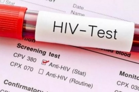 VB: la variante del VIH que es más virulenta y contagiosa