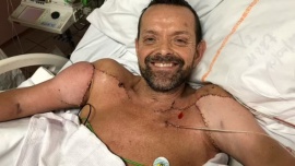 Un hombre recibió trasplante de brazos y pudo abrazar a su familia tras 20 años