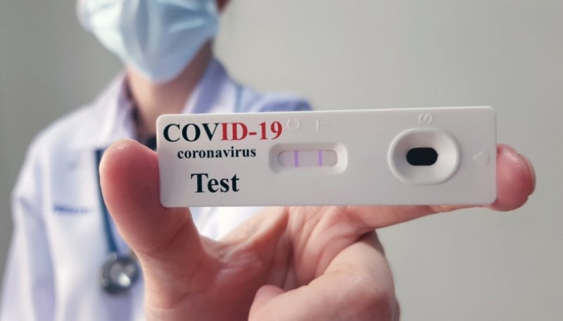 A su vez, 14 pacientes recibieron el alta de COVID-19; lo que representa un total de 186 activos.