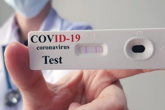 A su vez, 14 pacientes recibieron el alta de COVID-19; lo que representa un total de 186 activos.