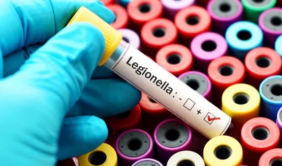 Qué es la Legionella
