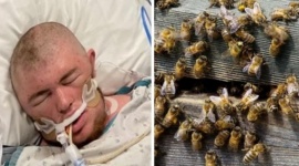 Sobrevivió de milagro tras ser picado 20 mil veces por abejas asesinas africanas