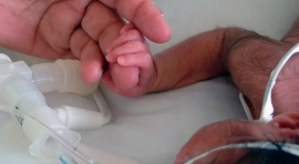 Se registró el nacimiento de una bebé con cola de casi 6 centímetros de largo