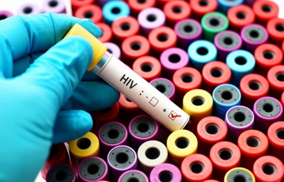 Tercer caso en el mundo de curación del VIH luego de un trasplante de células madre