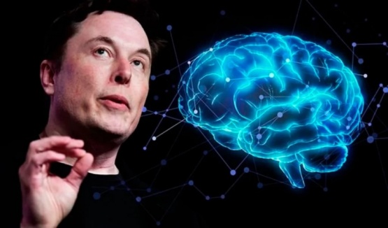 Neuralink fue autorizada a ensayar implantes cerebrales en humanos