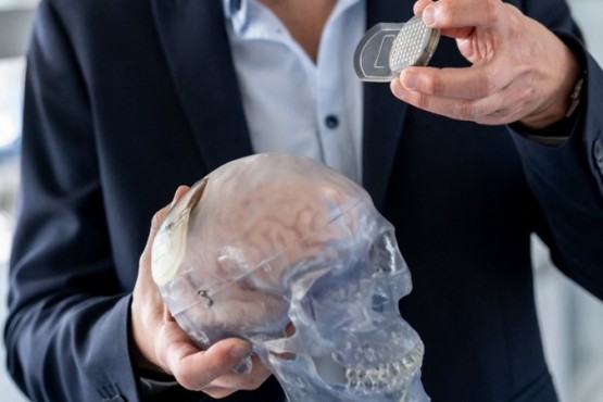 Implantes cerebrales: la carrera hacia el cíborg cobra impulso