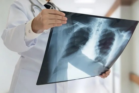 Ezequiel Piedra: “Los rayos X cambiaron drásticamente todas las medicinas”