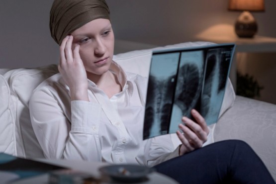 Crecen los casos y la mortalidad por cáncer de pulmón entre las mujeres