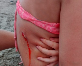 Un lobo marino mordió a una nena peritense de 10 años