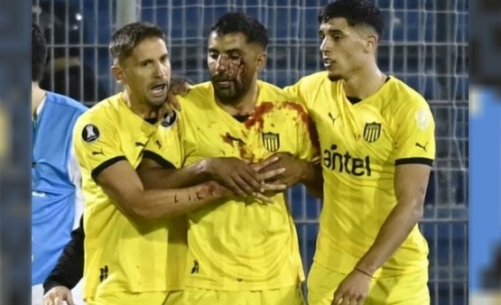 Un jugador de Peñarol recibió un corte tras ser agredido por un hincha de Rosario Central