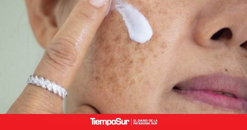 50% de los adultos a nivel mundial presenta algún trastorno en la pigmentación de su piel