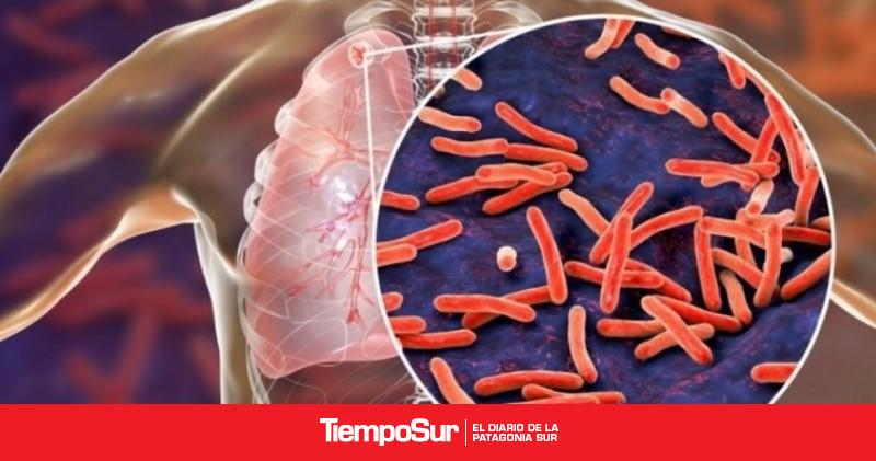 Tos, fiebre y pérdida de peso: las señales de alerta