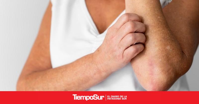 Mejorar el abordaje de enfermedades inmunomediadas de la piel