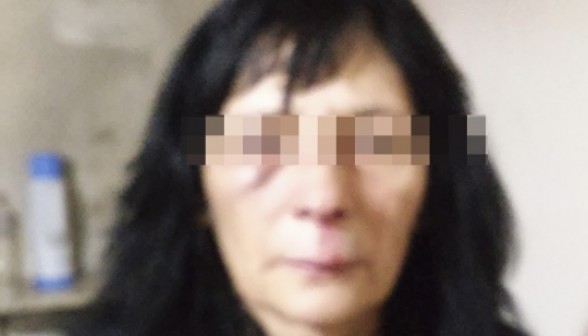 La mamá de Cintia presentó visibles golpes en el rostro. Esto fue constatado por el médico policial. 